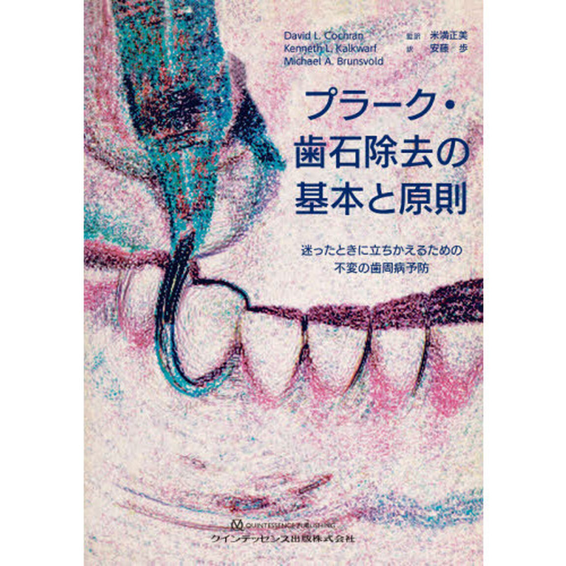 プラーク・歯石除去の基本と原則　迷ったときに立ちかえるための不変の歯周病予防