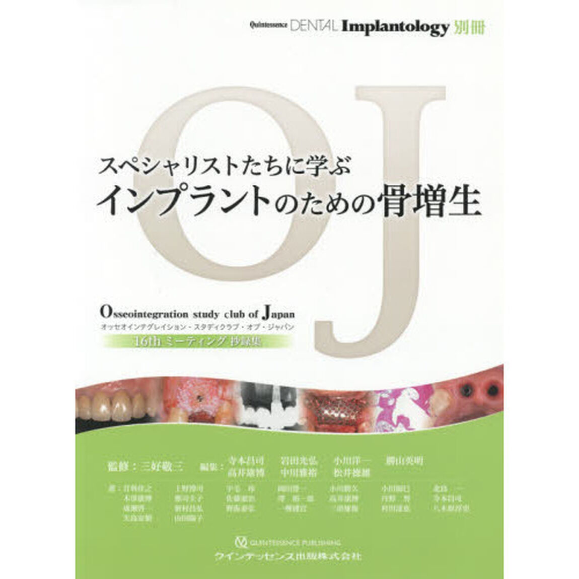 スペシャリストたちに学ぶインプラントのための骨増生