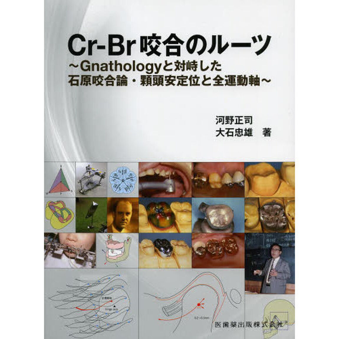 Ｃｒ‐Ｂｒ咬合のルーツ　Ｇｎａｔｈｏｌｏｇｙと対峙した石原咬合論・顆頭安定位と全運動軸