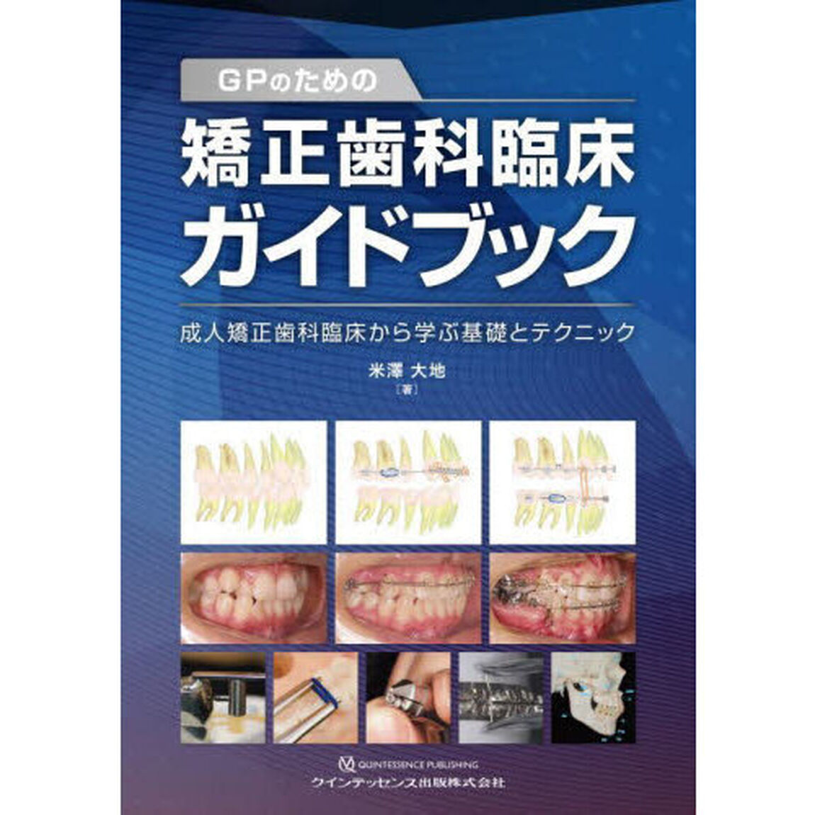 ＧＰのための矯正歯科臨床ガイドブック　成人矯正歯科臨床から学ぶ基礎とテクニック