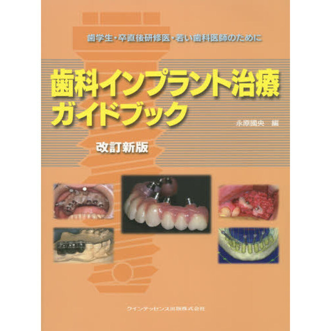 歯科インプラント治療ガイドブック　歯学生・卒直後研修医・若い歯科医師のために「改訂新版」