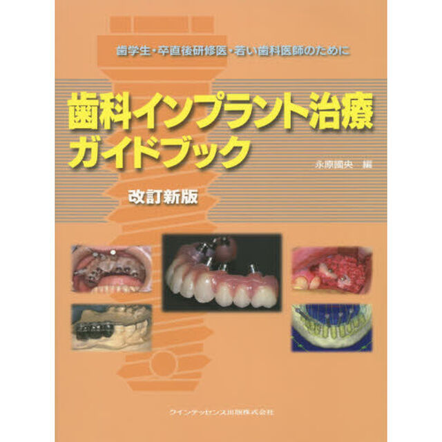 歯科インプラント治療ガイドブック　歯学生・卒直後研修医・若い歯科医師のために「改訂新版」