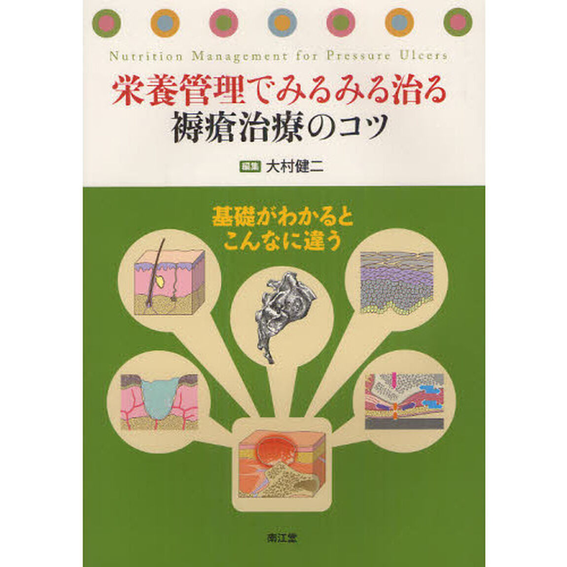 栄養管理でみるみる治る褥瘡治療のコツ　基礎がわかるとこんなに違う