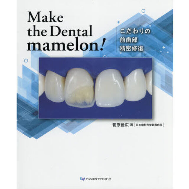 Ｍａｋｅ　ｔｈｅ　Ｄｅｎｔａｌ　ｍａｍｅｌｏｎ！　こだわりの前歯部精密修復