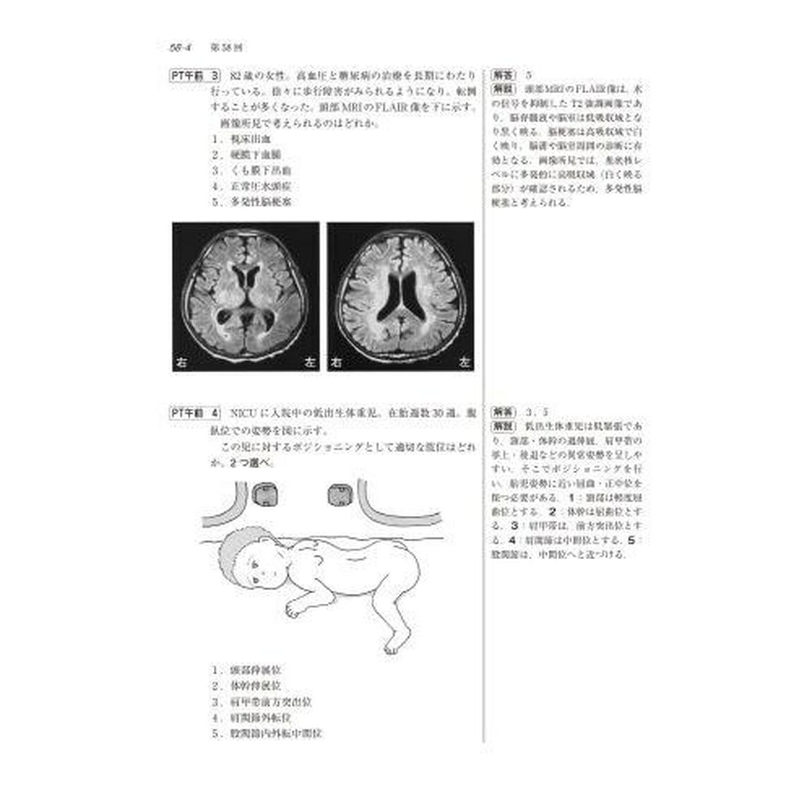 理学療法士・作業療法士国家試験問題解答と解説　第５４－５８回