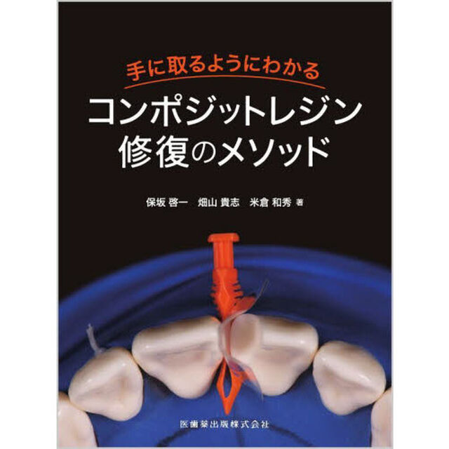 手に取るようにわかるコンポジットレジン修復のメソッド