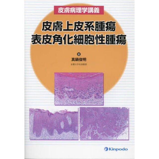 皮膚上皮系腫瘍　表皮角化細胞性腫瘍　皮膚病理学講義