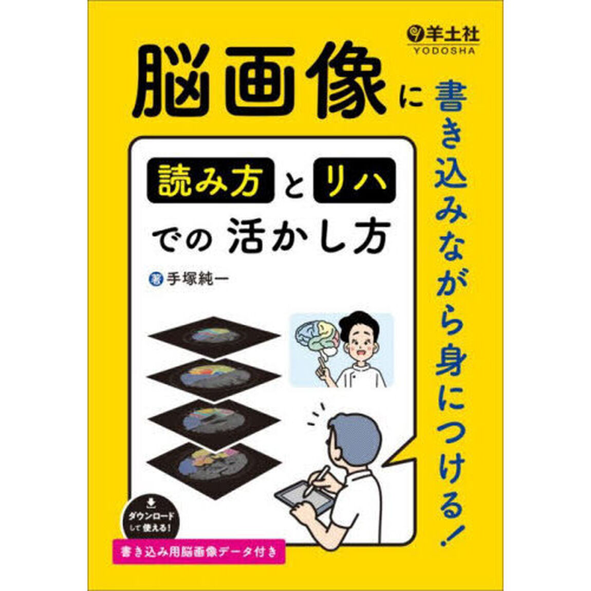 脳画像に書き込みながら身につける！読み方とリハでの活かし方