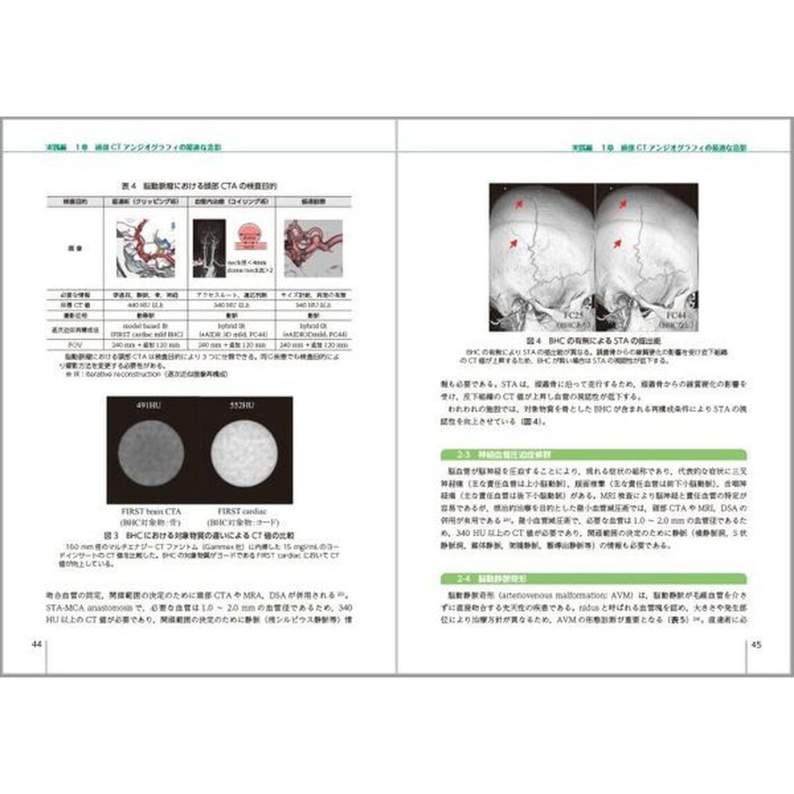 ｐＣＯＰの基礎と臨床応用　ＣＴにおける造影シミュレーション