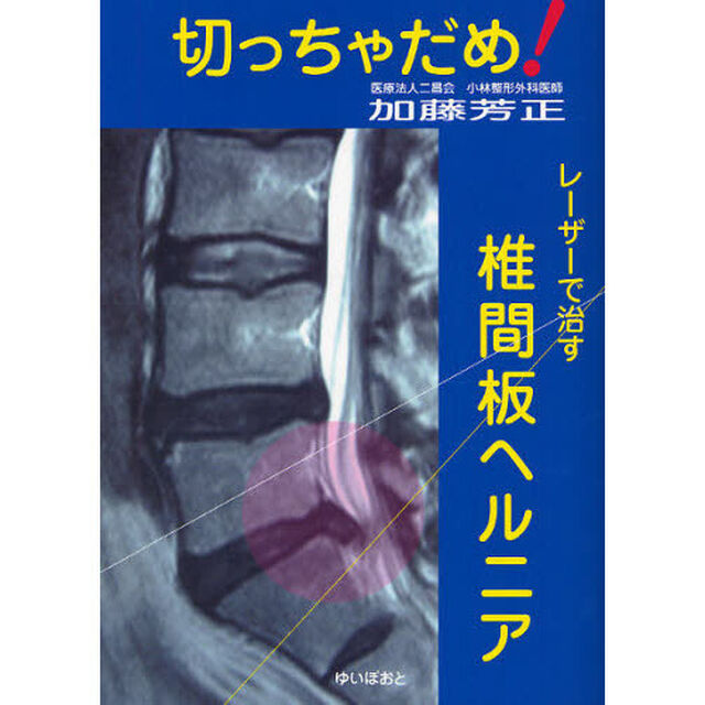 切っちゃだめ！レーザーで治す椎間板ヘルニア