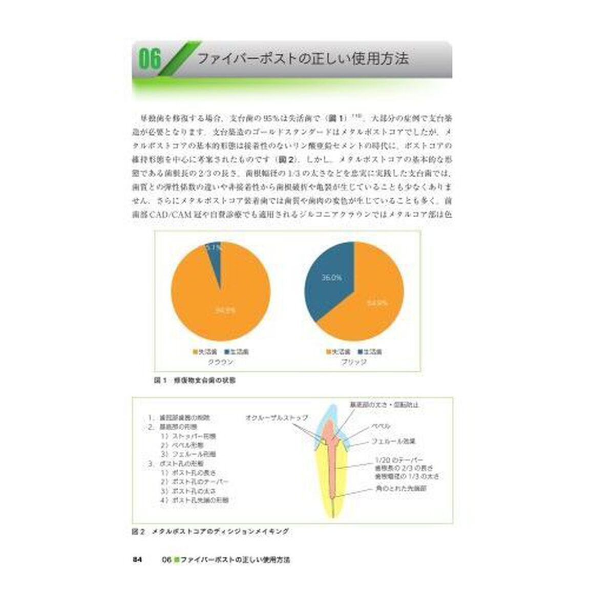 ＣＡＤ／ＣＡＭ活用による歯冠修復治療　メタルフリーの歴史と展望