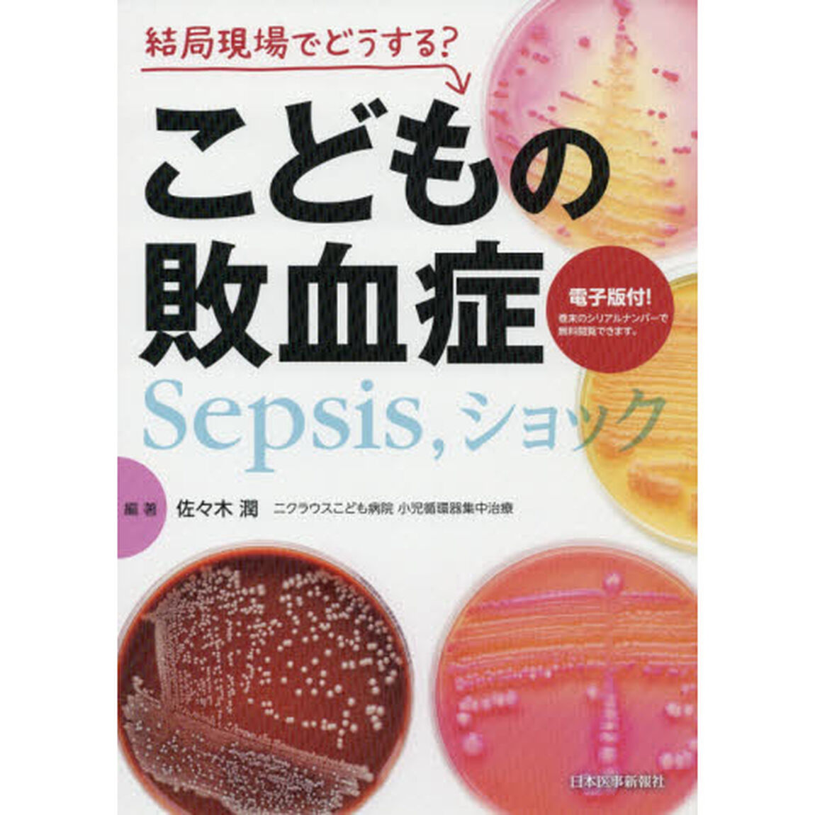 結局現場でどうする？こどもの敗血症　Ｓｅｐｓｉｓ，ショック