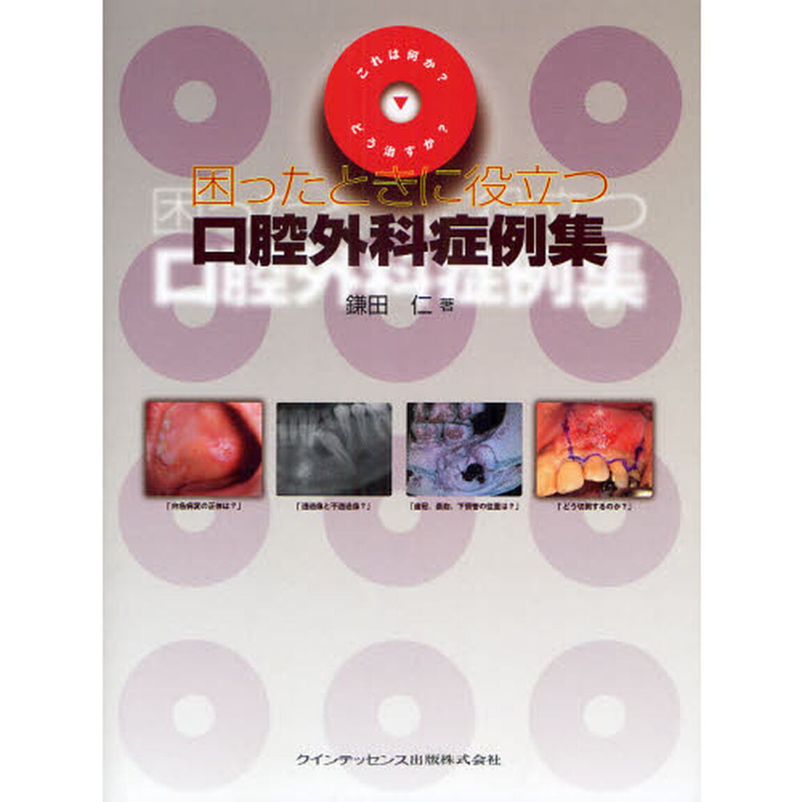 困ったときに役立つ口腔外科症例集　これは何か？どう治すか？