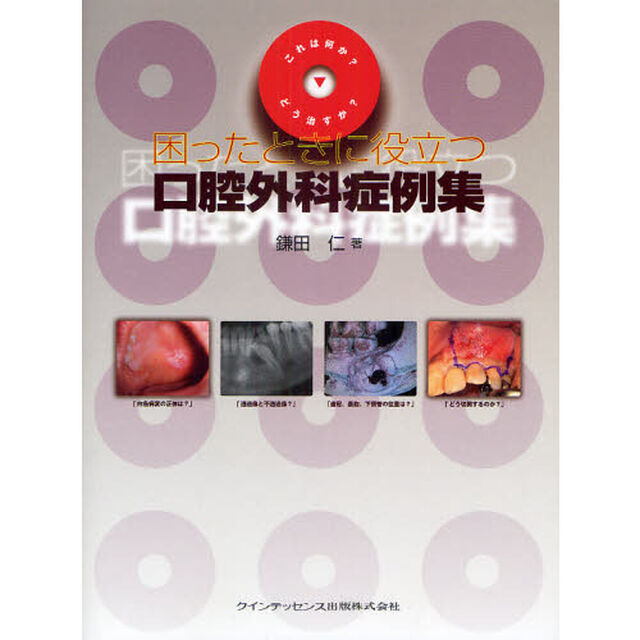 困ったときに役立つ口腔外科症例集　これは何か？どう治すか？