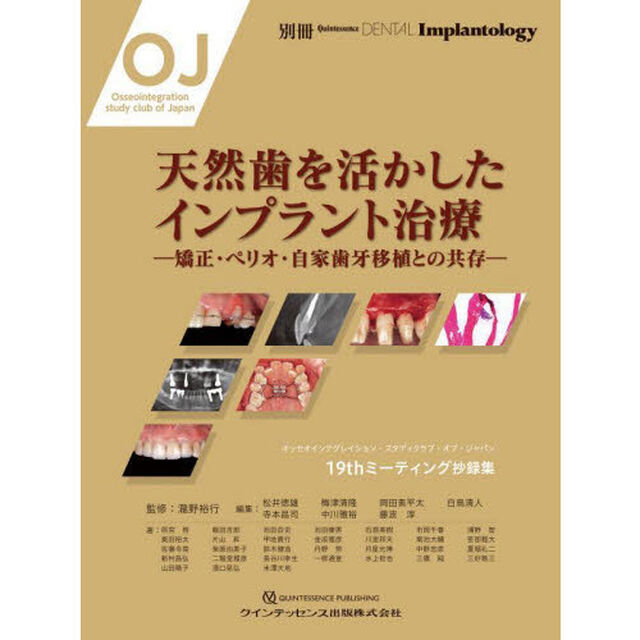 天然歯を活かしたインプラント治療　矯正・ペリオ・自家歯牙移植との共存