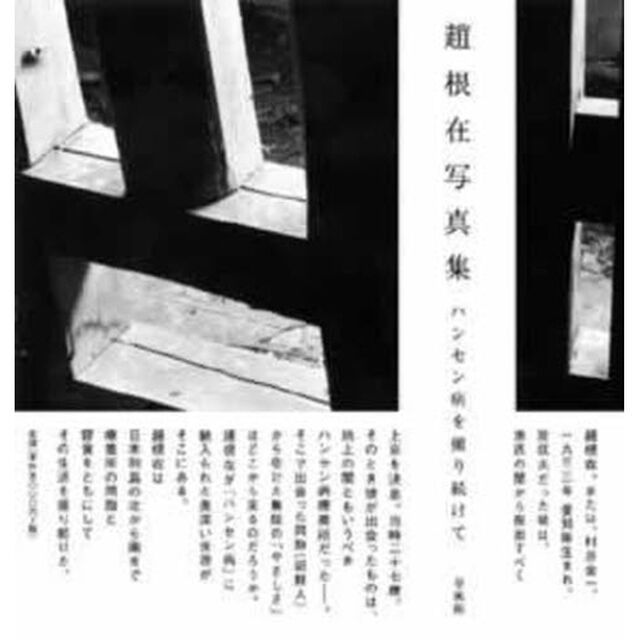 趙根在写真集　ハンセン病を撮り続けて