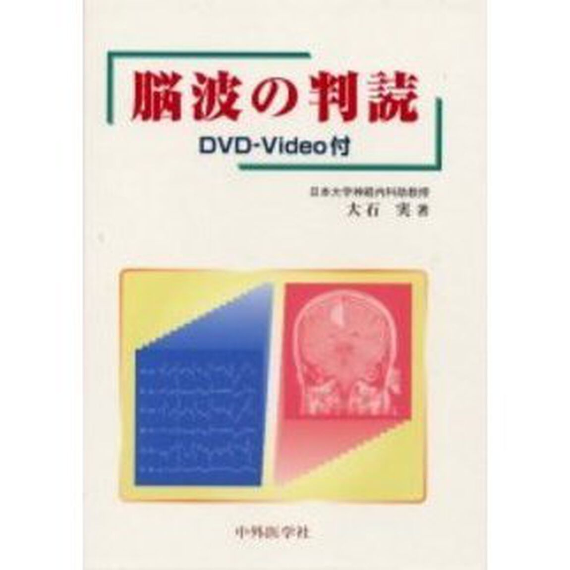 脳波の判読