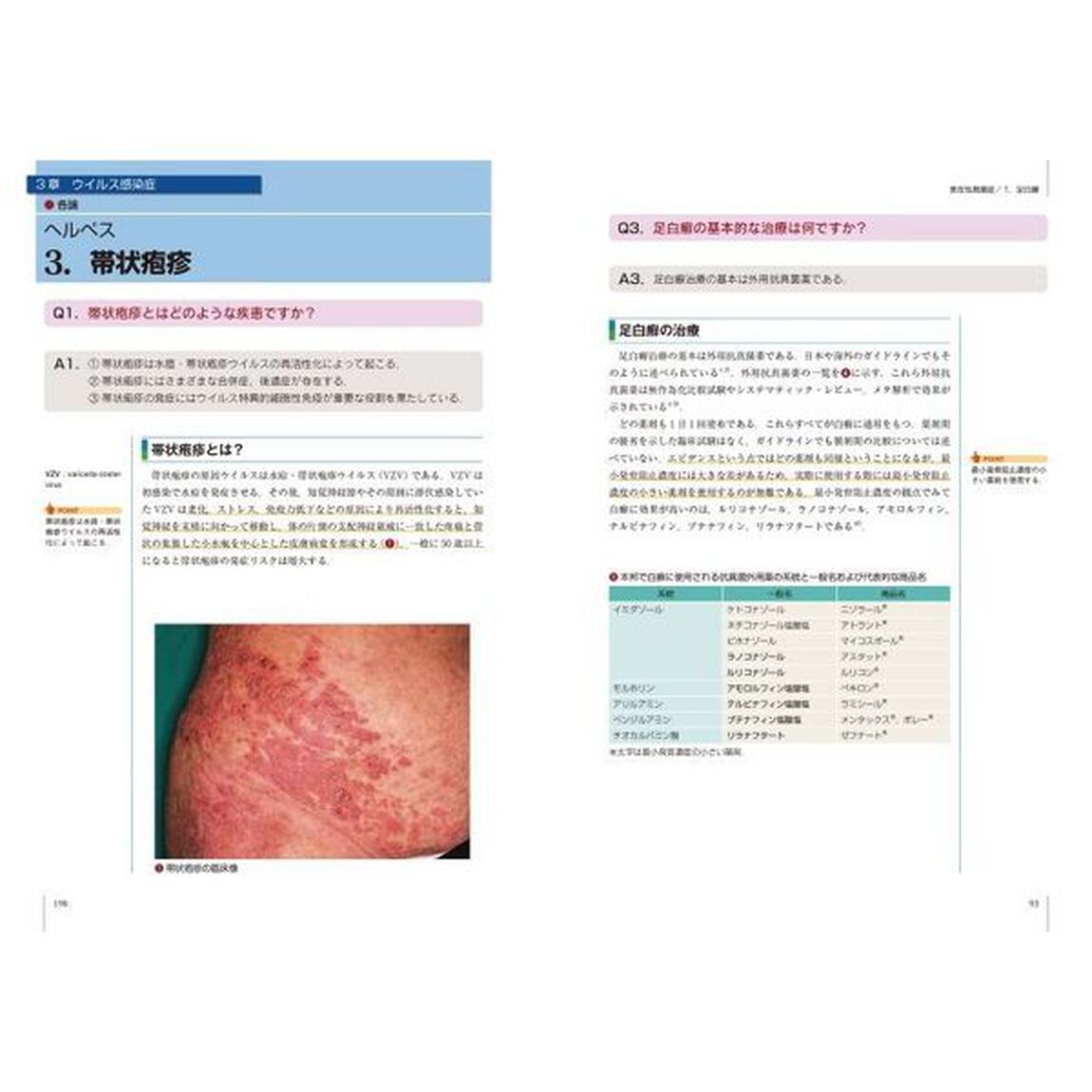 エビデンスに基づくＱ＆Ａでわかる皮膚感染症治療