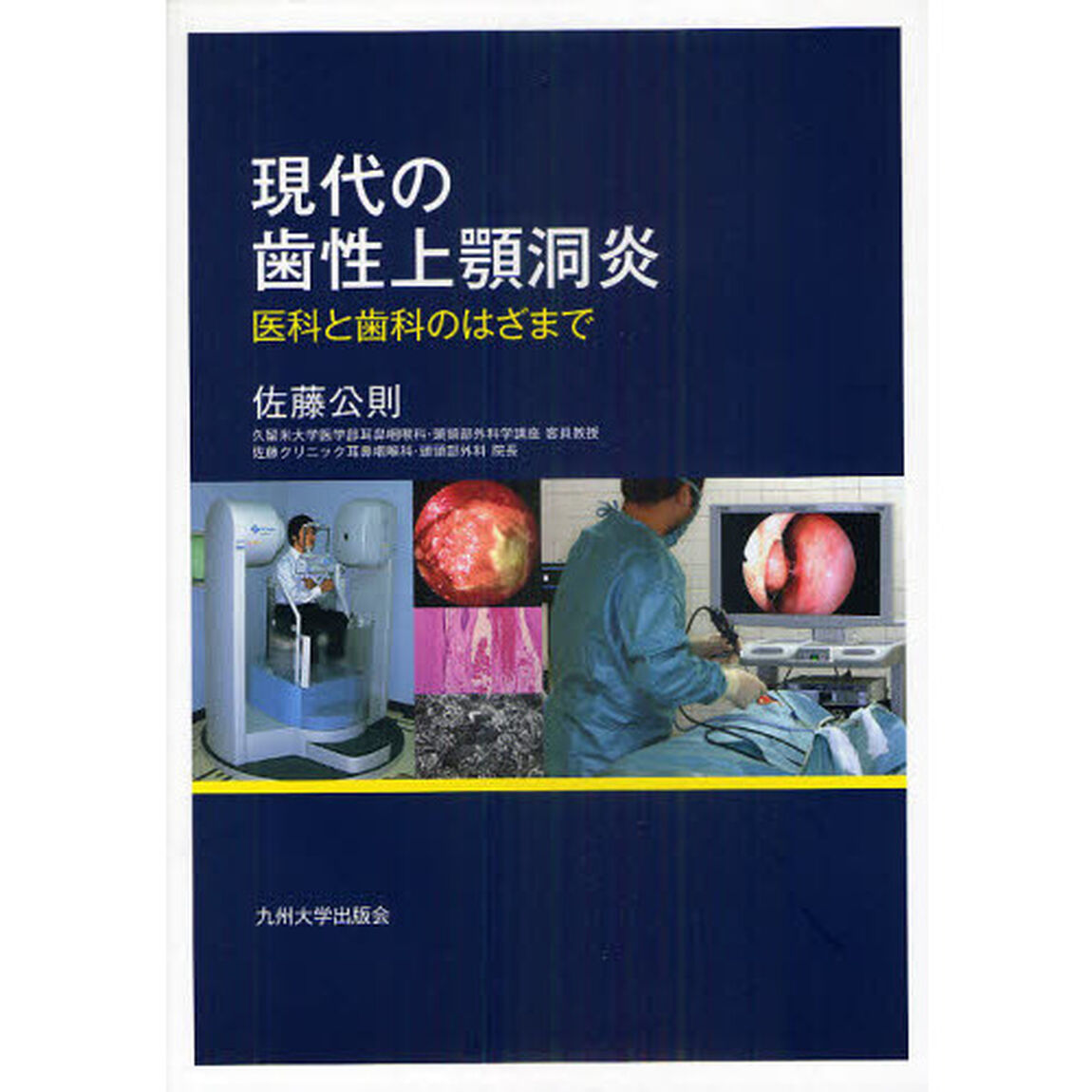 現代の歯性上顎洞炎　医科と歯科のはざまで