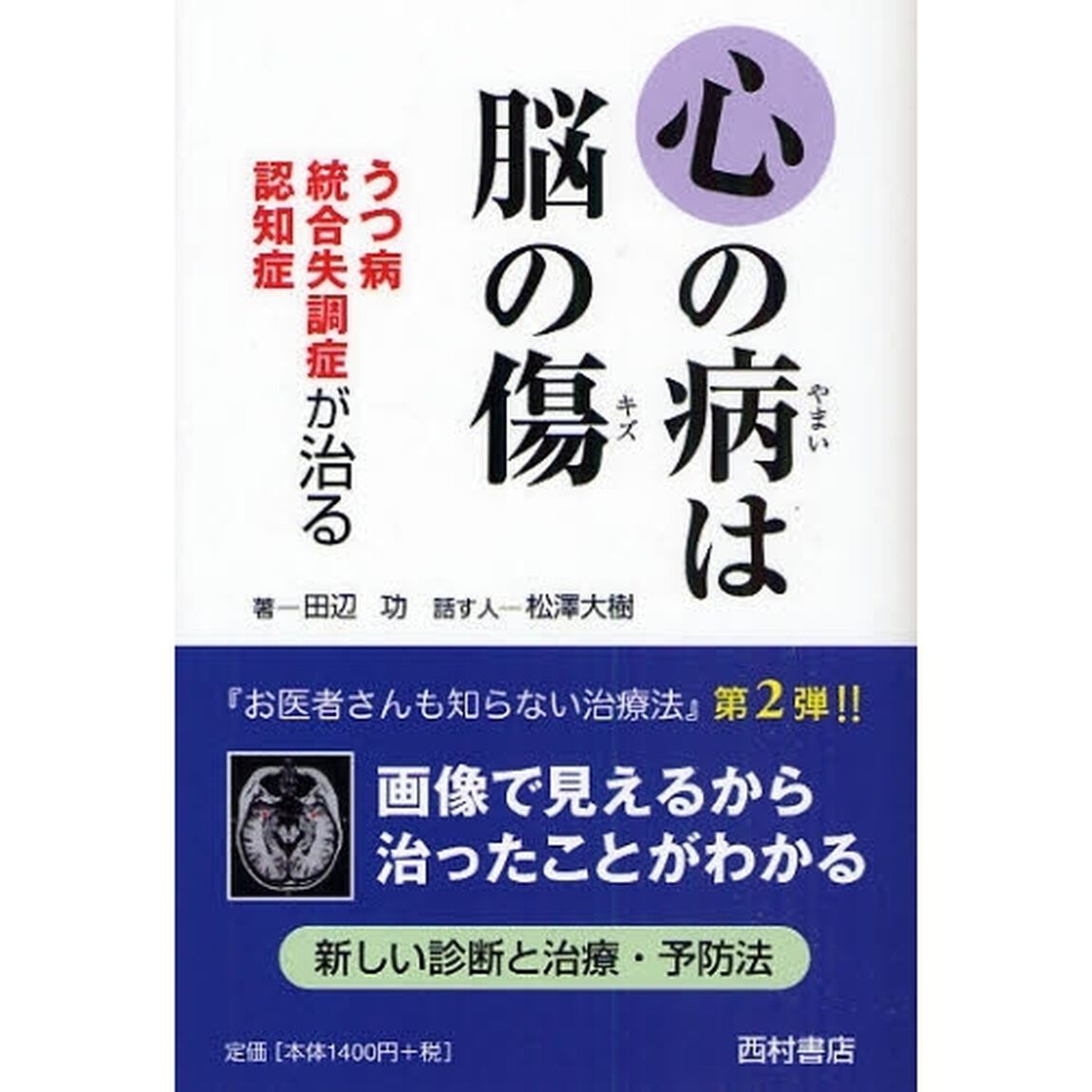 心の病は脳の傷　うつ病　統合失調症　認知症が治る