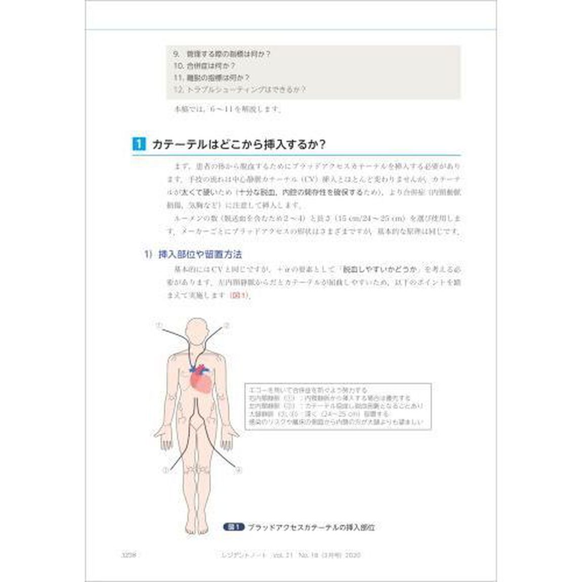 レジデントノート　プライマリケアと救急を中心とした総合誌　Ｖｏｌ．２１Ｎｏ．１８（２０２０－３）「血液浄化療法　１からわかりやすく教えます」