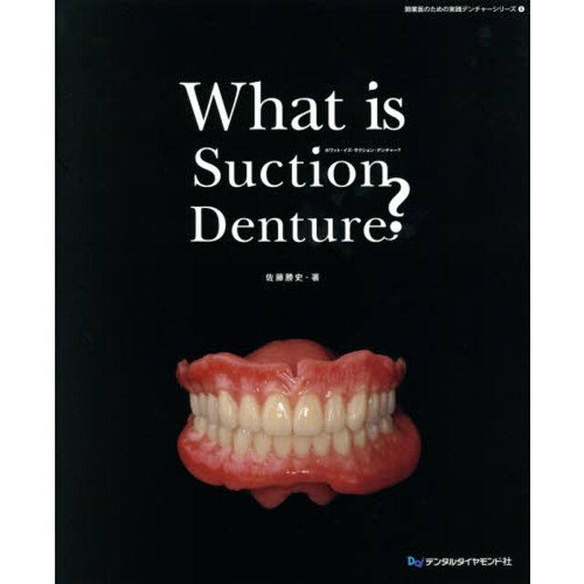 Ｗｈａｔ　ｉｓ　Ｓｕｃｔｉｏｎ　Ｄｅｎｔｕｒｅ？