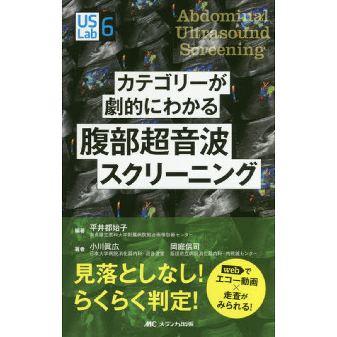 カテゴリーが劇的にわかる腹部超音波スクリーニング　ｗｅｂでエコー動画&times;走査がみられる！　見落としなし！らくらく判定！