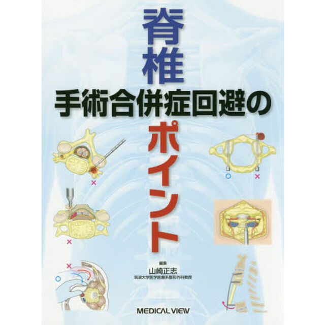 脊椎手術合併症回避のポイント