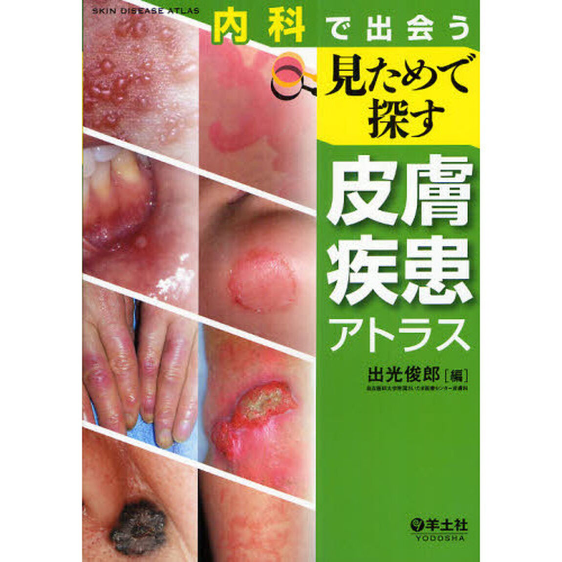内科で出会う見ためで探す皮膚疾患アトラス