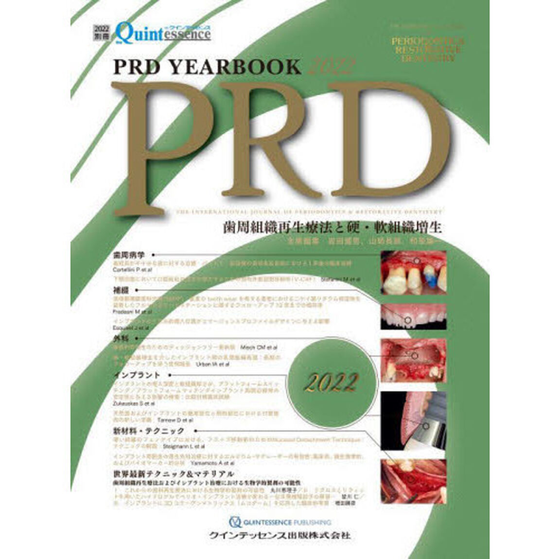ＰＲＤ　ＹＥＡＲＢＯＯＫ　２０２２「歯周組織再生療法と硬・軟組織増生」