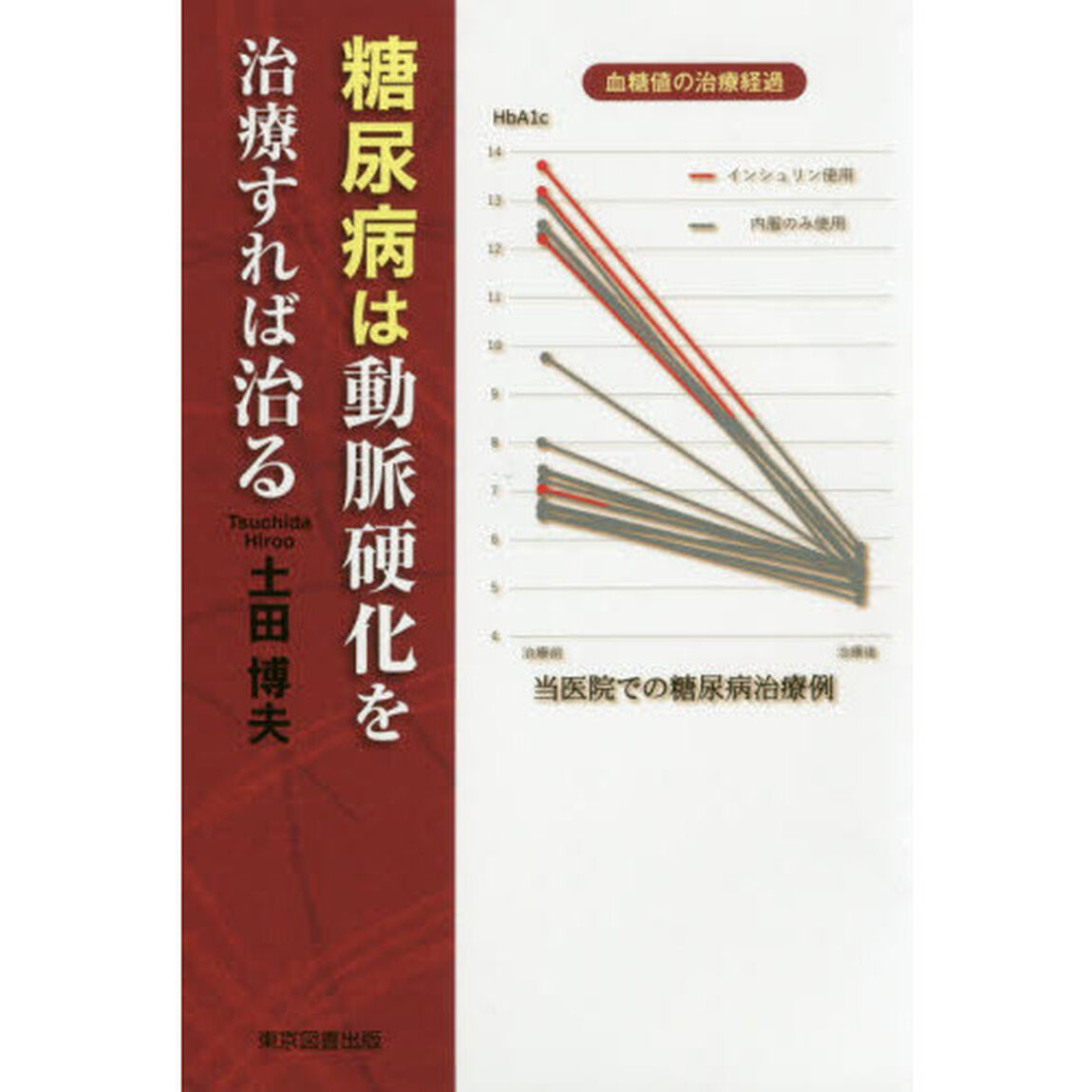 糖尿病は動脈硬化を治療すれば治る