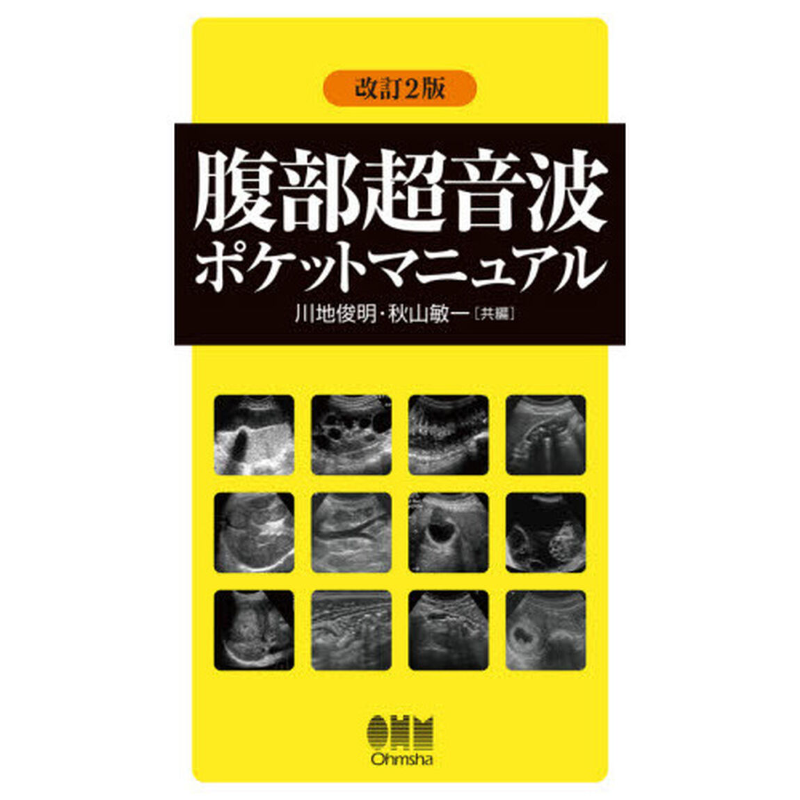 腹部超音波ポケットマニュアル「改訂２版」