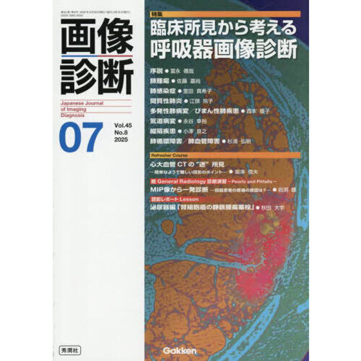 画像診断　Ｖｏｌ．４５Ｎｏ．８（２０２５年７月号）「特集臨床所見から考える呼吸器画像診断」