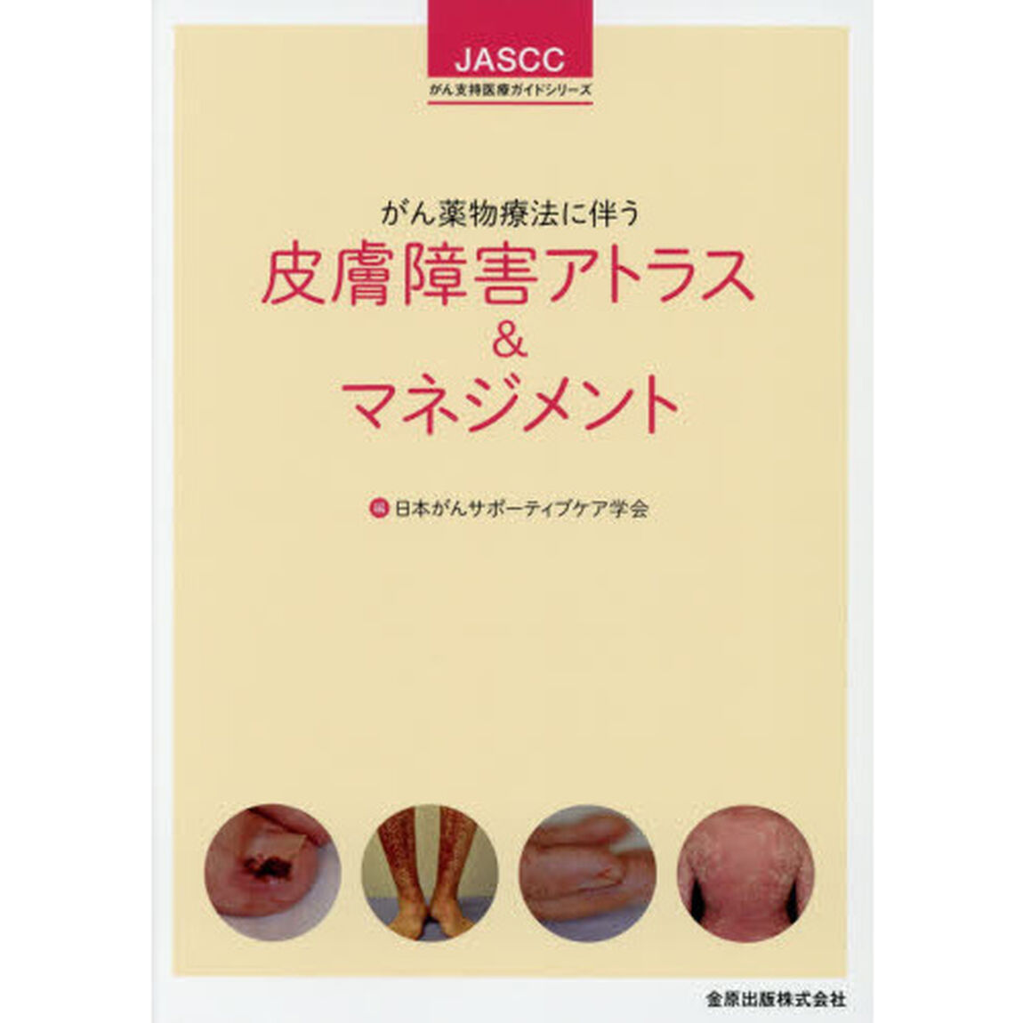 がん薬物療法に伴う皮膚障害アトラス＆マネジメント