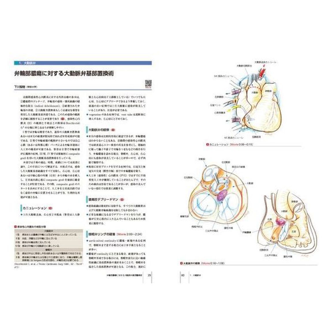 心臓血管外科手術エクセレンス　手術画と動画で伝える　２「弁膜症の手術」