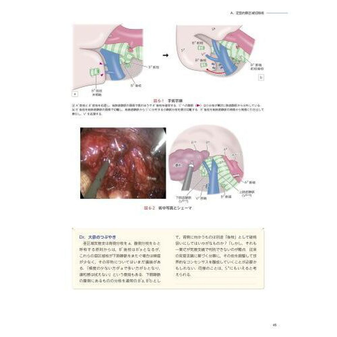 胸腔鏡下肺区域切除術のすべて　３ＤＣＴ画像と動画でコツがつかめる
