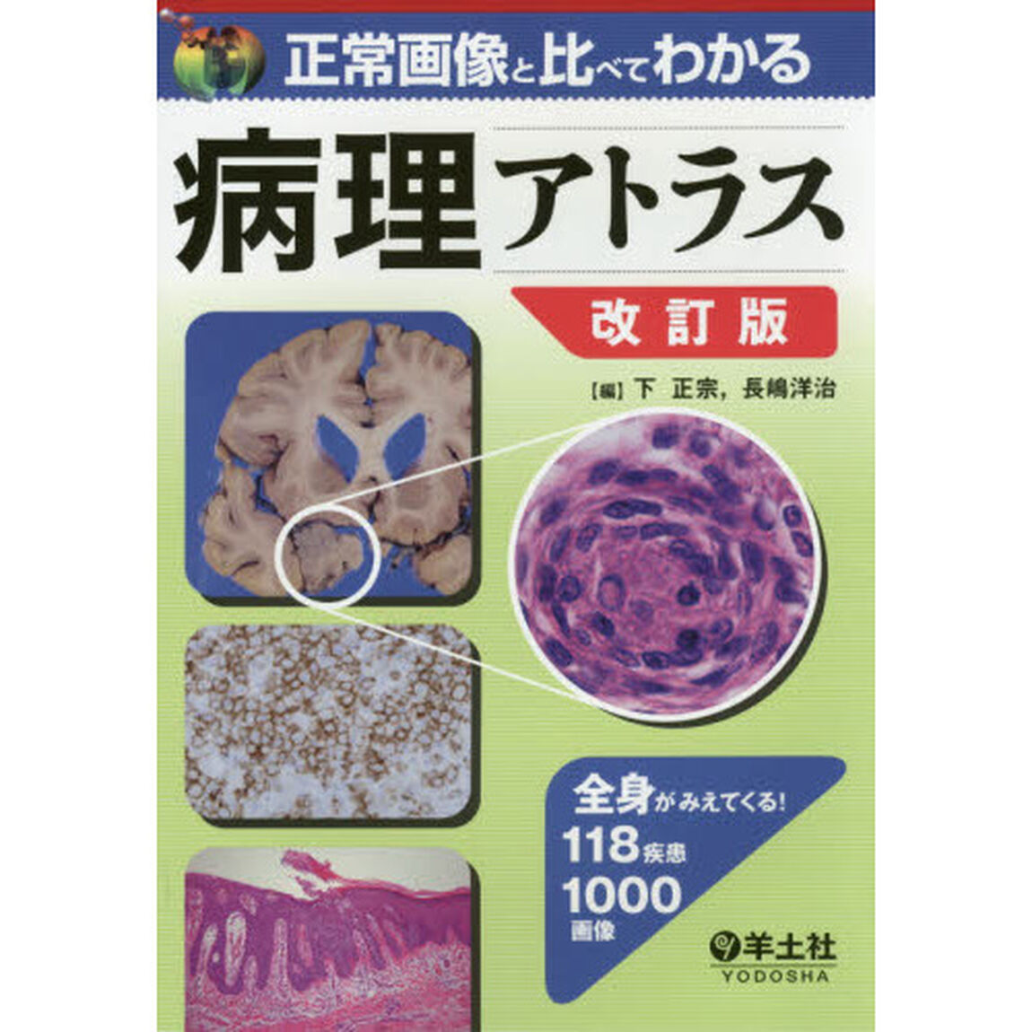 正常画像と比べてわかる病理アトラス　全身がみえてくる！１１８疾患１０００画像「改訂版」
