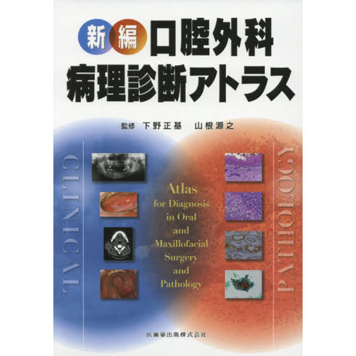 新編口腔外科・病理診断アトラス