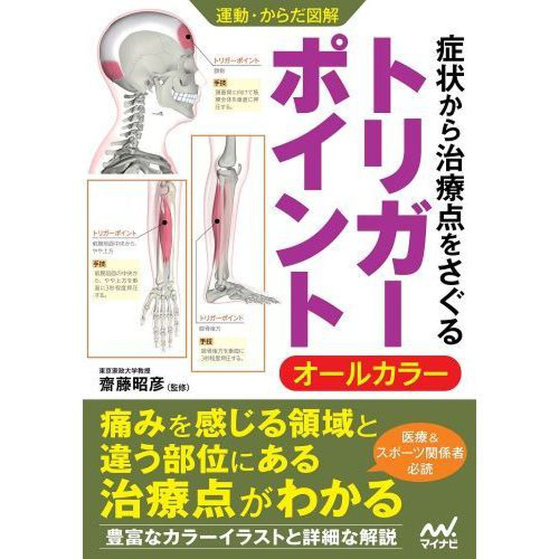 症状から治療点をさぐるトリガーポイント　オールカラー