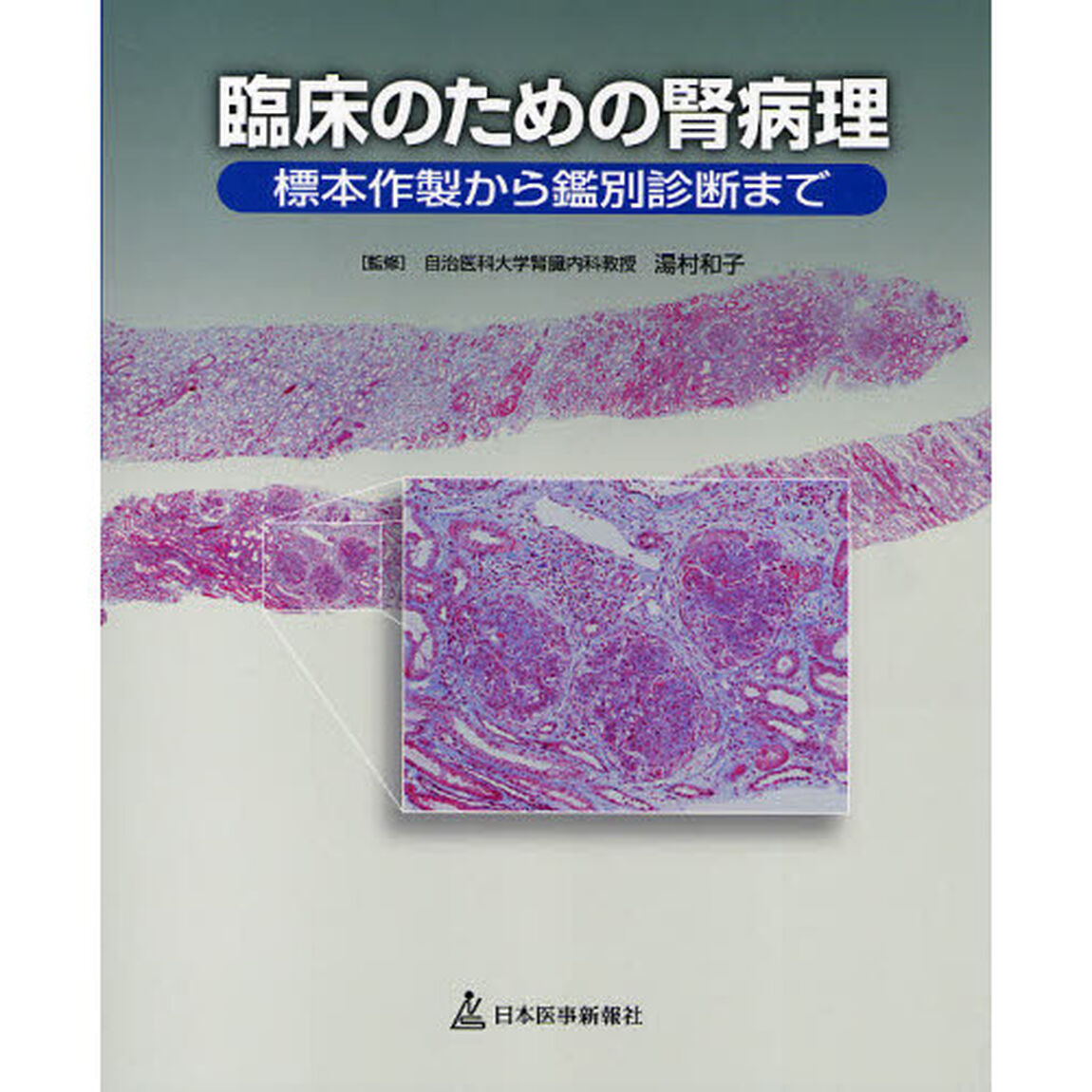 臨床のための腎病理　標本作製から鑑別診断まで