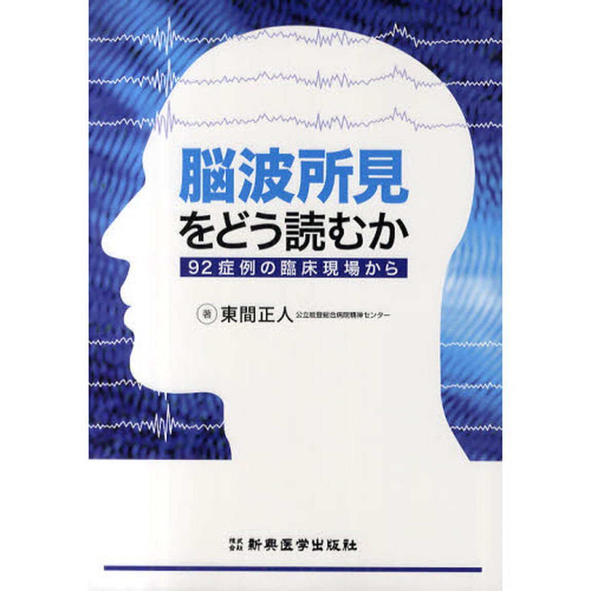 脳波所見をどう読むか　９２症例の臨床現場から
