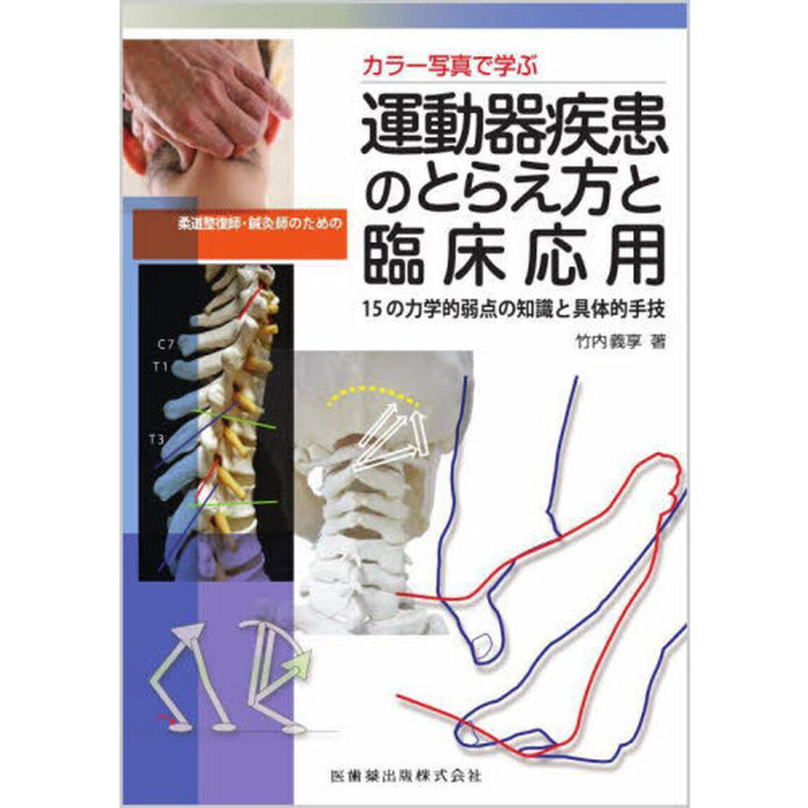 カラー写真で学ぶ柔道整復師・鍼灸師のための運動器疾患のとらえ方と臨床応用　１５の力学的弱点の知識と具体的手技