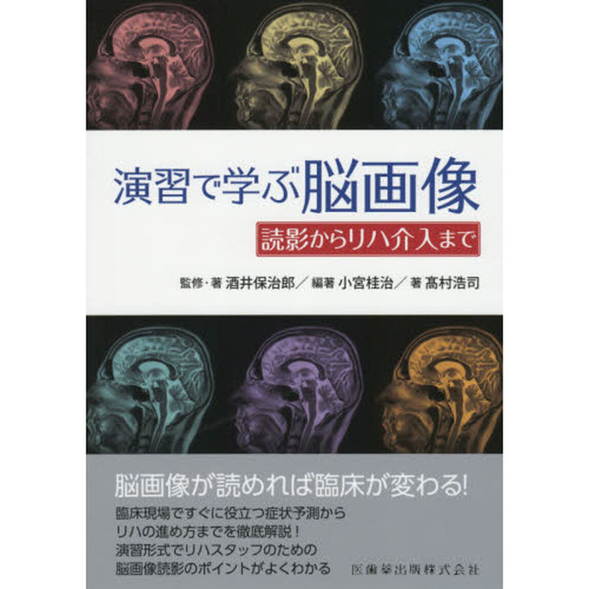 演習で学ぶ脳画像　読影からリハ介入まで