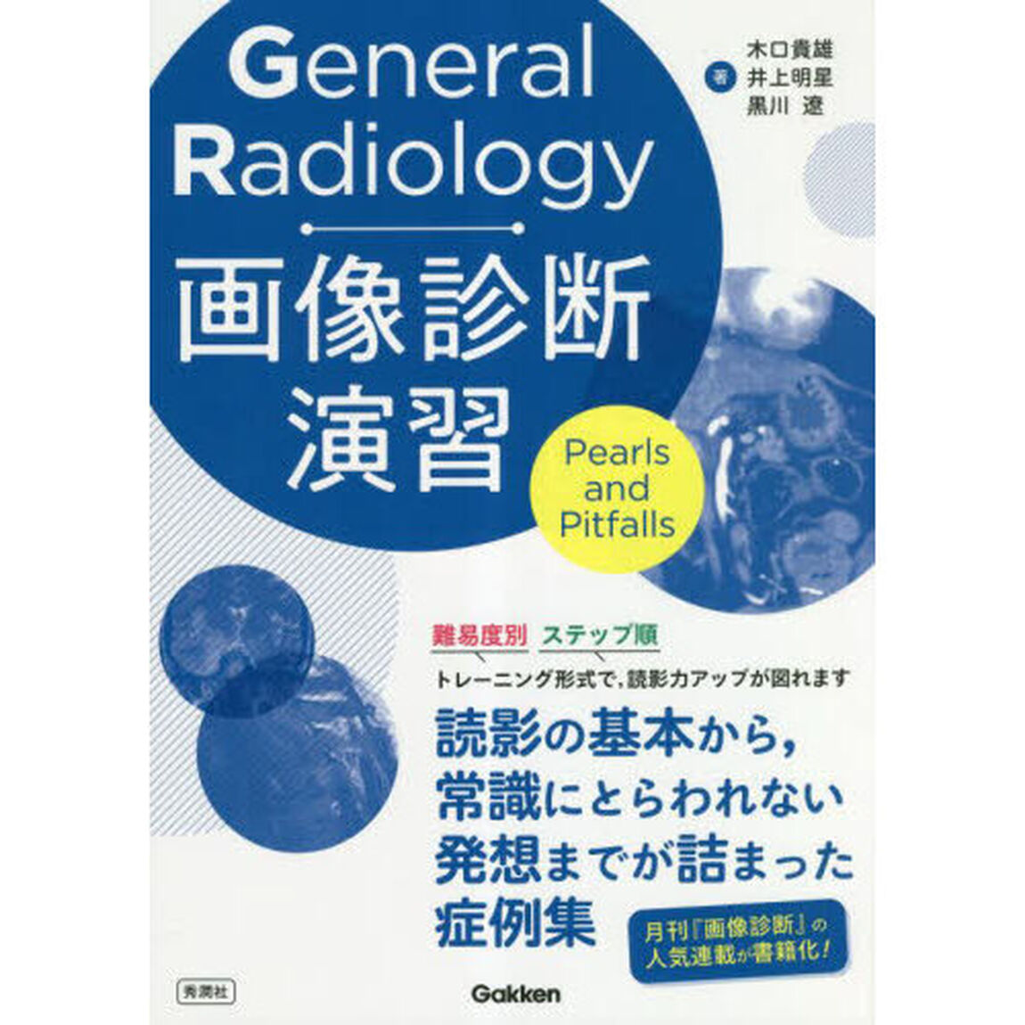 Ｇｅｎｅｒａｌ　Ｒａｄｉｏｌｏｇｙ画像診断演習　Ｐｅａｒｌｓ　ａｎｄ　Ｐｉｔｆａｌｌｓ