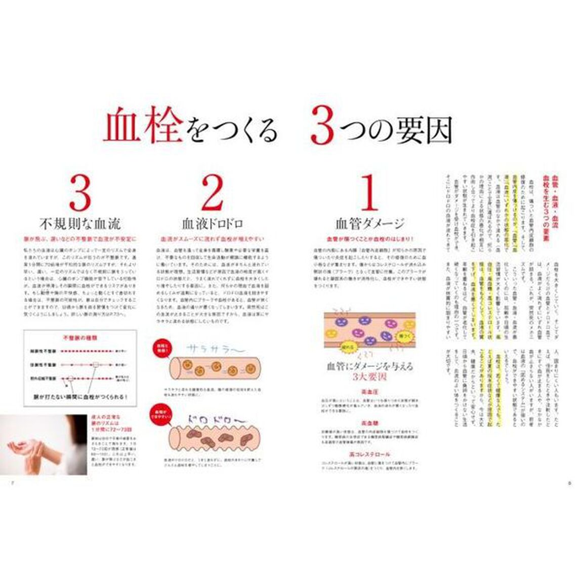 血栓をつくらない！　脳梗塞、心筋梗塞、肺塞栓など突然死のリスクを減らす