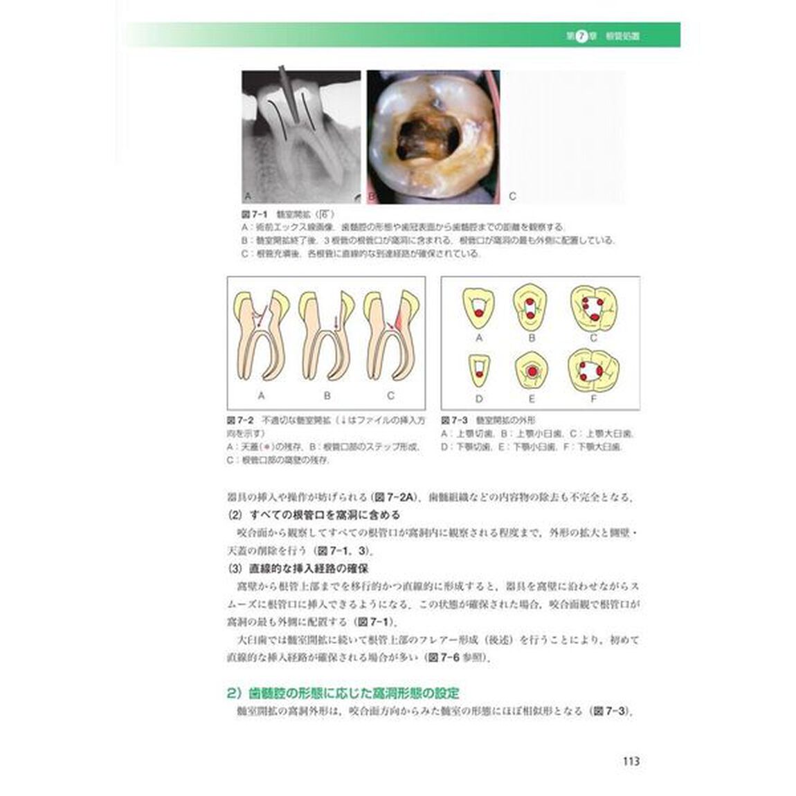 歯内治療学「第６版」