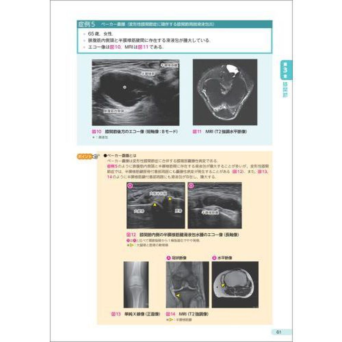 エキスパートが教える運動器エコーの見かた　診療の鍵となる着眼点と所見の解釈　下肢
