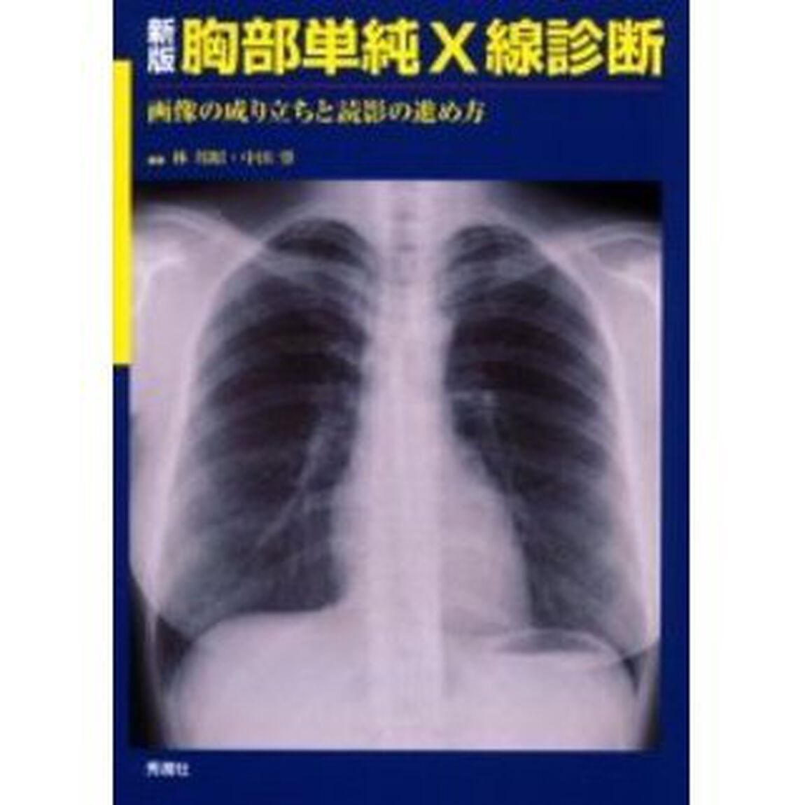 胸部単純Ｘ線診断　画像の成り立ちと読影の進め方「新版」