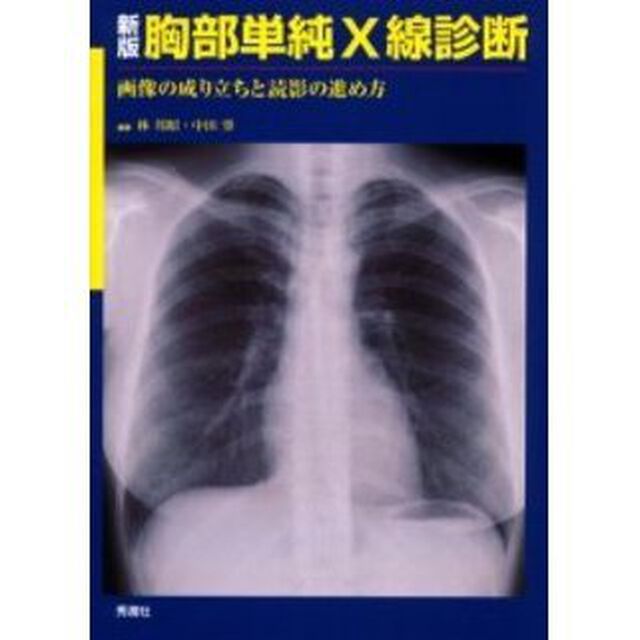 胸部単純Ｘ線診断　画像の成り立ちと読影の進め方「新版」