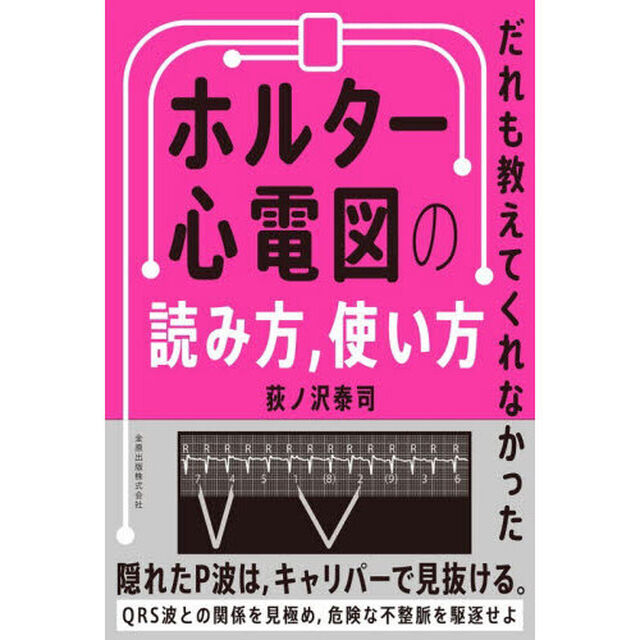 だれも教えてくれなかったホルター心電図の読み方，使い方